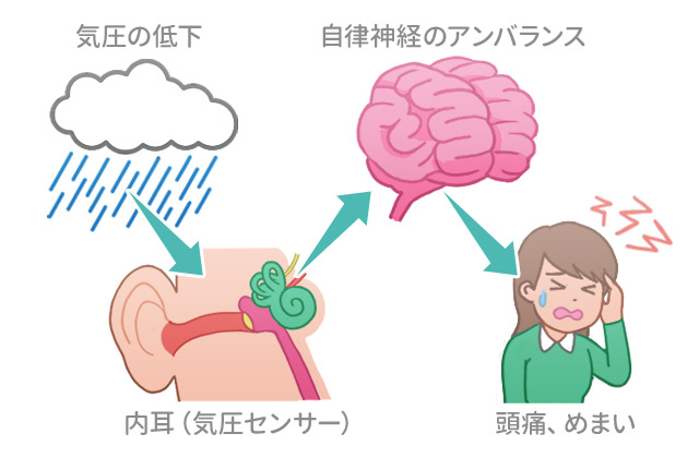 気圧の低下→内耳（気圧センサー）→自律神経のアンバランス→頭痛、めまい